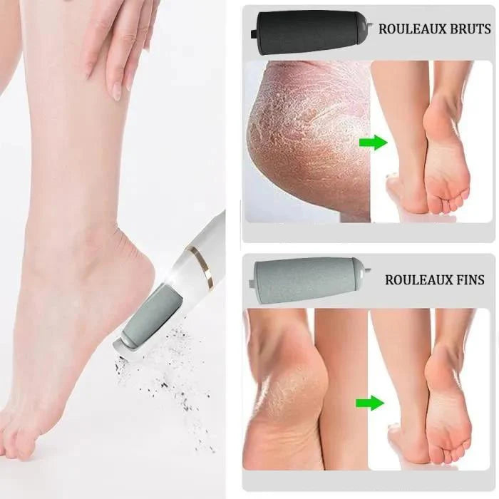 Râpe pied électrique Women Care™